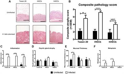 Hexane Extracts of Calophyllum brasiliense Inhibit the Development of Gastric Preneoplasia in Helicobacter felis Infected INS-Gas Mice
